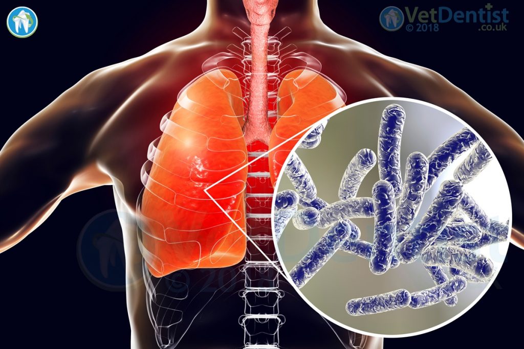 Legionella Pathology