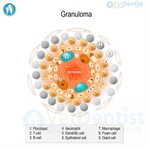 NTM Granuloma